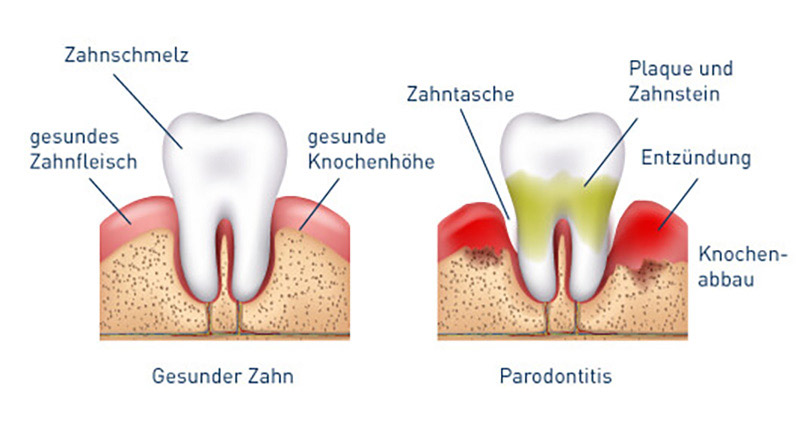 Mundhygiene